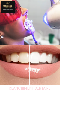 Formation Blanchiment dentaire